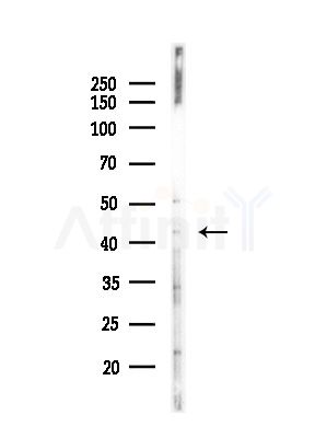 SGCA Antibody - Western blot analysis of lysates from Hela cells(starvation,24h treatment), using SGCA Antibody at 1/1000 dilution.