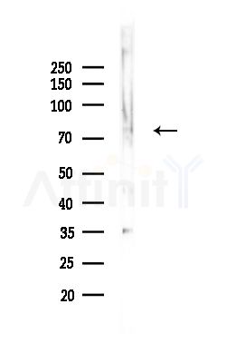 AMPH Antibody - Western blot analysis of lysates from Hela cells(heat-shock,45min treatment), using AMPH Antibody at 1/1000 dilution.