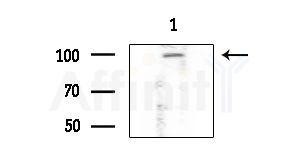 APBB2 Antibody - Western blot analysis of extracts from Mouse liver, using APBB2 Antibody at 1/1000 dilution.