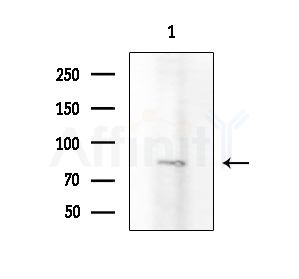 APLP2 Antibody - Western blot analysis of extracts from EC304 cells, using APLP2 Antibody at 1/1000 dilution.