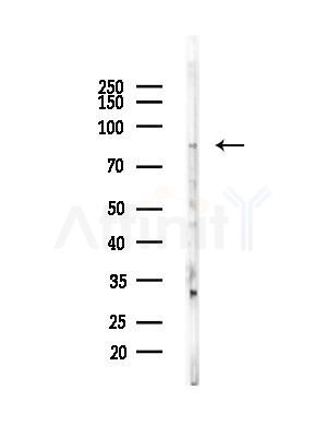 APLP2 Antibody - Western blot analysis of lysates from EC304 cells, using APLP2 Antibody at 1/1000 dilution.