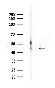 ALS2CR4 Antibody - Western blot analysis of lysates from B16F10-LUC cells(heat-shock,45min treatment), using ALS2CR4 Antibody at 1/1000 dilution.