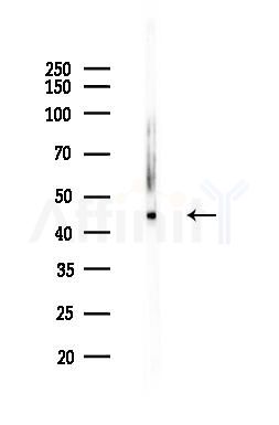 ALS2CR4 Antibody - Western blot analysis of lysates from HepG2 cells(heat-shock,45min treatment), using ALS2CR4 Antibody at 1/1000 dilution.