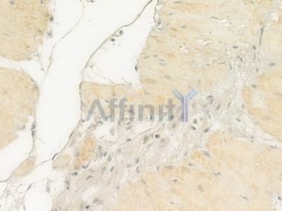 ALS2CR8 Antibody - DF3775 at 1/100 staining human normal gastric tissue by IHC-P.