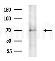 KAL1 Antibody - Western blot analysis of extracts from Hela cells, using KAL1 Antibody at 1/1000 dilution.