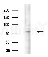 KAL1 Antibody - Western blot analysis of extracts from Mouse liver, using KAL1 Antibody at 1/1000 dilution.