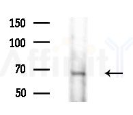 KAL1 Antibody - Western blot analysis of extracts from HepG2 cells(LPS 4h treatment), using KAL1 Antibody at 1/1000 dilution.