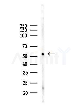 ARMC6 Antibody - Western blot analysis of lysates from Mouse testis, using ARMC6 Antibody at 1/1000 dilution.