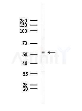 ARMC6 Antibody - Western blot analysis of lysates from Rat brain, using ARMC6 Antibody at 1/1000 dilution.