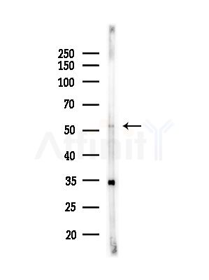 ARSA Antibody - Western blot analysis of lysates from Hela cells(starvation,24h treatment), using ARSA Antibody at 1/1000 dilution.