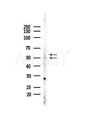 ARSA Antibody - Western blot analysis of lysates from Mouse liver, using ARSA Antibody at 1/1000 dilution.