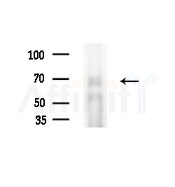 ARSE Antibody - Western blot analysis of extracts from HepG2 cells(starvation,24h treatment), using ARSE Antibody at 1/1000 dilution.