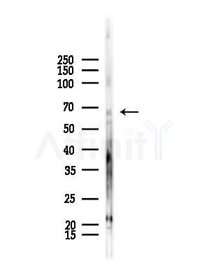 ARSE Antibody - Western blot analysis of lysates from HepG2 cells(starvation,24h treatment), using ARSE Antibody at 1/1000 dilution.