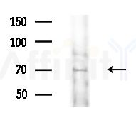 ARSF Antibody - Western blot analysis of extracts from HepG2 cells(LPS 4h treatment), using ARSF Antibody at 1/1000 dilution.
