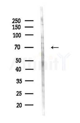 ARSF Antibody - Western blot analysis of lysates from HepG2 cells(LPS 4h treatment), using ARSF Antibody at 1/1000 dilution.