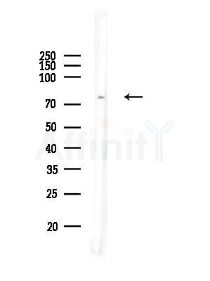 ATXN7L2 Antibody - Western blot analysis of lysates from Mouse testis, using ATXN7L2 Antibody at 1/1000 dilution.
