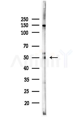 DDX19B Antibody - Western blot analysis of lysates from HUVEC cells(UV,30min treatment), using DDX19B Antibody at 1/1000 dilution.