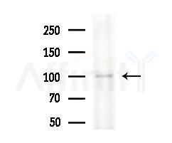 DDX54 Antibody - Western blot analysis of extracts from HepG2 cells
(heat-shock treatment), using DDX54 Antibody at 1/1000 dilution.