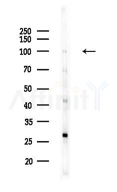 DDX54 Antibody - Western blot analysis of lysates from HepG2 cells(heat-shock,45min treatment), using DDX54 Antibody at 1/1000 dilution.
