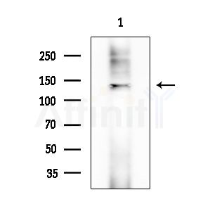 Atrophin 1 Antibody - Western blot analysis of extracts from EC304 cells, using Atrophin 1 Antibody at 1/1000 dilution.