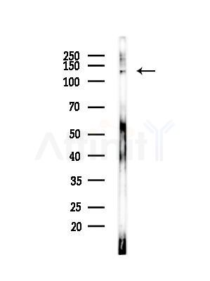 Atrophin 1 Antibody - Western blot analysis of lysates from EC304 cells, using Atrophin 1 Antibody at 1/1000 dilution.