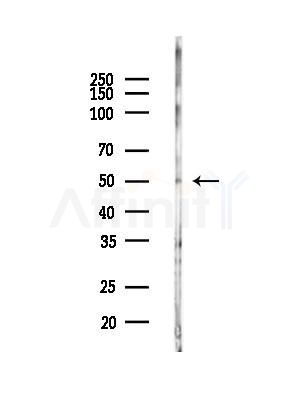 BNIP2 Antibody - Western blot analysis of lysates from HUVEC cells(LPC4h treatment), using BNIP2 Antibody at 1/1000 dilution.