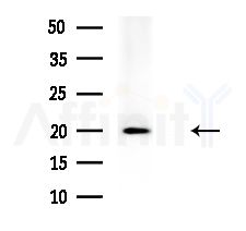 BOK Antibody - Western blot analysis of lysates from HepG2 cells
(heat-shock treatment), using BOK Antibody at 1/1000 dilution.