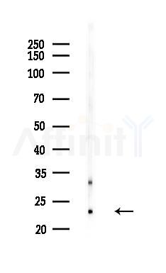 BOK Antibody - Western blot analysis of lysates from HepG2 cells(heat-shock,45min treatment), using BOK Antibody at 1/1000 dilution.