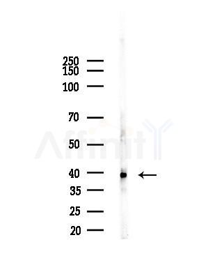 B3GALT4 Antibody - Western blot analysis of lysates from EC304 cells, using B3GALT4 Antibody at 1/1000 dilution.