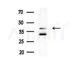 B4GALT1 Antibody - Western blot analysis of lysates from B16F10-LUC cells
(heat-shock treatment), using B4GALT1 Antibody at 1/1000 dilution.