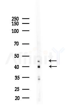 B4GALT1 Antibody - Western blot analysis of lysates from B16F10-LUC cells(heat-shock,45min treatment), using B4GALT1 Antibody at 1/1000 dilution.