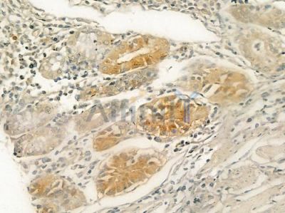 B4GALT1 Antibody - DF3839 at 1/100 staining human normal gastric tissue by IHC-P.