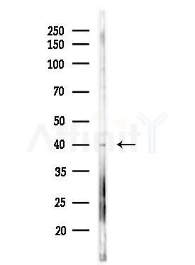 B4GALT3 Antibody - Western blot analysis of lysates from Hela cells(starvation,24h treatment), using B4GALT3 Antibody at 1/1000 dilution.