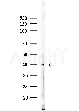 B4GALT3 Antibody - Western blot analysis of lysates from HUVEC cells(UV,30min treatment), using B4GALT3 Antibody at 1/1000 dilution.