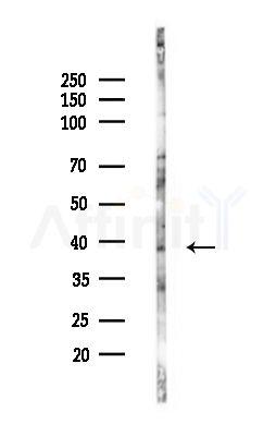 B4GALT5 Antibody - Western blot analysis of lysates from RAW264.