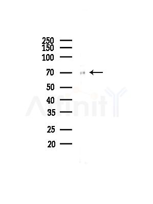 GUSB Antibody - Western blot analysis of lysates from COLO205 cells(UV,30min treatment), using GUSB Antibody at 1/1000 dilution.