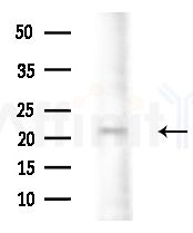 GUSBL1 Antibody - Western blot analysis of extracts from Rat brain, using GUSBL1 Antibody at 1/1000 dilution.