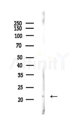 GUSBL1 Antibody - Western blot analysis of lysates from Rat brain, using GUSBL1 Antibody at 1/1000 dilution.