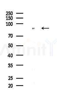 SLC27A5 Antibody - Western blot analysis of lysates from HepG2 cells, using SLC27A5 Antibody at 1/1000 dilution.