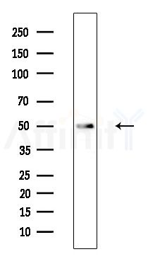 BMP3 Antibody - Western blot analysis of extracts from Mouse liver, using BMP3 Antibody at 1/1000 dilution.