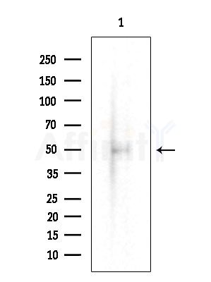 BAIAP2L2 Antibody - Western blot analysis of extracts from Rat testis, using BAIAP2L2 Antibody at 1/1000 dilution.