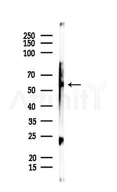 BAIAP2L2 Antibody - Western blot analysis of lysates from Rat testis, using BAIAP2L2 Antibody at 1/1000 dilution.