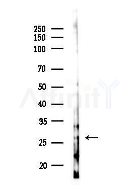 BCAS2 Antibody - Western blot analysis of lysates from COLO205 cells(UV,30min treatment), using BCAS2 Antibody at 1/1000 dilution.