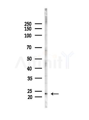 CHP2 Antibody - Western blot analysis of lysates from LoVo cells(heat-shock,45min treatment), using CHP2 Antibody at 1/1000 dilution.