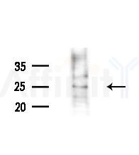 Calcipressin 1 Antibody - Western blot analysis of extracts from various samples, using Calcipressin 1 Antibody at 1/1000 dilution.