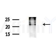 Calcipressin 1 Antibody - Western blot analysis of extracts from EC304 cells
(heat-shock treatment), using Calcipressin 1 Antibody at 1/1000 dilution.