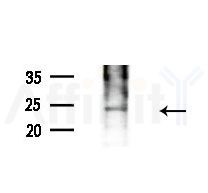 Calcipressin 1 Antibody - Western blot analysis of extracts from Mouse testis, using Calcipressin 1 Antibody at 1/1000 dilution.