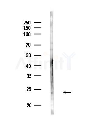 Calcipressin 1 Antibody - Western blot analysis of lysates from Mouse testis, using Calcipressin 1 Antibody at 1/1000 dilution.