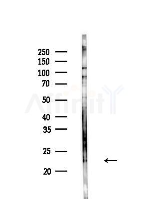 Calcipressin 1 Antibody - Western blot analysis of lysates from EC304 cells(heat-shock treatment), using Calcipressin 1 Antibody at 1/1000 dilution.