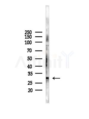 KCNMB2 Antibody - Western blot analysis of lysates from LoVo cells(heat-shock,45min treatment), using KCNMB2 Antibody at 1/1000 dilution.